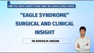 Eagle Syndrome High Yield Topic for Neet pg I FMGE I INICET I MRCS IUSMLE I NEET SS I Mch [upl. by Karalynn139]