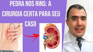 Cirurgia de pedra nos rins qual a melhor escolha para seu caso [upl. by Eisiam]