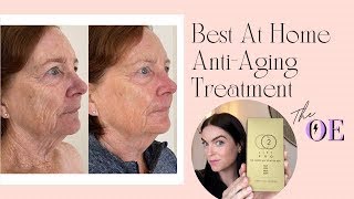 Best At Home AntiAging Treatment  CO2 Lift Pro Carboxy Therapy Mask [upl. by Ecirtaed]