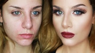 Base VISO Pelle PERFETTA come Photoshop Coprire OCCHIAIEBRUFOLIROSSORI  Make up Tutorial [upl. by Heydon]