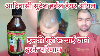 Adivasi Hair oil review iske puri sachai jane [upl. by Fessuoy]