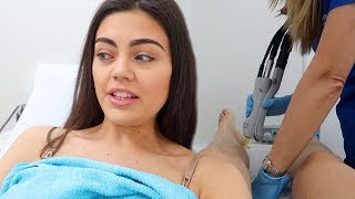 LASER HAIR REMOVAL THE TRUTH DOES IT HURT [upl. by Nerrak87]