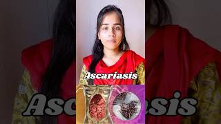 Ascariasis  protozoan disease🦠causes symptoms  transmission ascaris neet biology shortvideo [upl. by Coleman]