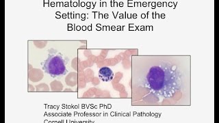 Hematology in the Emergency Setting The Value of the Blood Smear Exam  conference recording [upl. by Adohr]