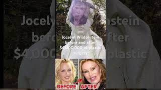 Jocelyn Wildenstein – before and after 4000000 of plastic surgery [upl. by Ahen]