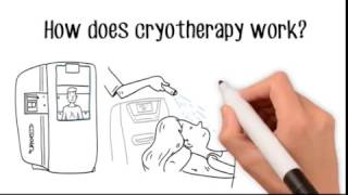 What is Cryotherapy  Cryotherapy Whiteboard Video [upl. by Ulane]