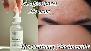 The Ordinary Serum Niacinamide 10  zinc 1 skincare theordinary niacinamideserum [upl. by Anelahs475]