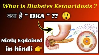 Diabetic Ketoacidosis  What is DKA   in hindi Nursing Guidance  Explanation in hindi [upl. by Eey]