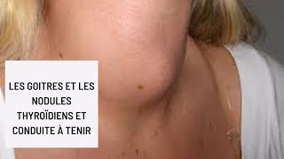 Les goitres et les nodules thyroïdiens et conduite à tenir [upl. by Anilec]