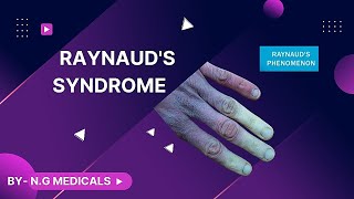 Raynauds Disease  WITH EASY NOTES FULL EXPLANATION IN HINDI BY NG MEDICALS [upl. by Kleeman]