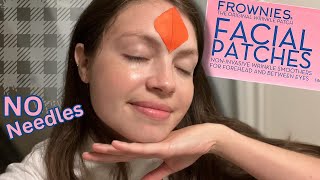 Frownies Review  Facial Patches as a Botox Alternative [upl. by Durham828]