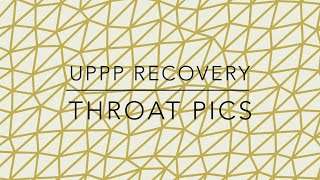 UPPP Patient Recovery Throat Pics [upl. by Junji769]