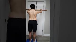 Schroth Method for Scoliosis and Kyphosis exercise Big Bow [upl. by Alta]