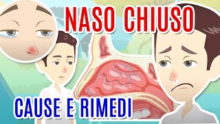 NASO CHIUSO cause diagnosi e cure per la CONGESTIONE NASALE [upl. by Asillim]