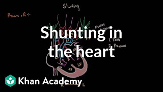 Shunting in the heart  Circulatory System and Disease  NCLEXRN  Khan Academy [upl. by Roque]