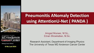 Technical Talk Predicting Immune Checkpoint Inhibitor Pneumonitis in Lung Cancer Patients Using [upl. by Vaden]