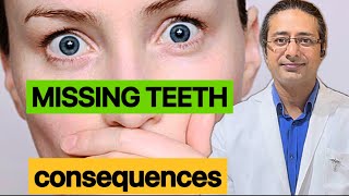 How to identify missing teeth problemsDisadvantages of missing teeth [upl. by Itin395]