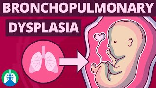 Bronchopulmonary Dysplasia BPD  Medical Definition and Explainer Video [upl. by Mendez]