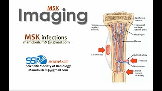 2 Imaging of Musculoskeletal infection Prof Mamdouh Mahfouz [upl. by Daveta]