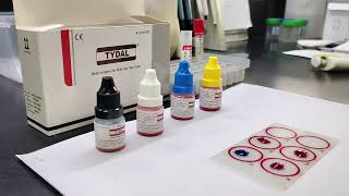 How to do WIDAL Test  Benifits of WIDAL tests  Test for Typhoid widaltest labtest [upl. by Outhe]