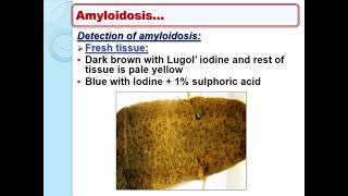 Lecture 9 Amyloidosis Hyalinosis and Pathological calcification [upl. by Oeak572]