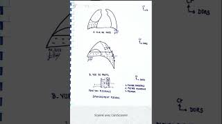 Épanchement pleural et ponction pleurale [upl. by Elma]