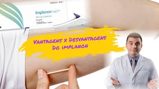 Vantagens e desvantagens do IMPLANON [upl. by Nhaj]