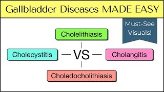 Cholecystitis vs Cholelithiasis vs Cholangitis vs Choledocholithiasis Nursing USMLE [upl. by Haronid]