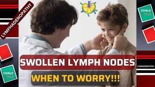 SWOLLEN LYMPH NODES LYMPHADENOPATHY [upl. by Tem346]