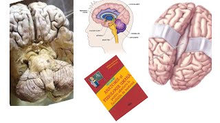 ADMITERE MEDICINA Barron’s Cap11 Organizarea sistemului nervos part2Encefalul [upl. by Marsh]