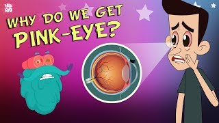 What Causes Conjunctivitis  CONJUNCTIVITIS  PinkEye  The Dr Binocs Show  Peekaboo Kidz [upl. by Katina269]