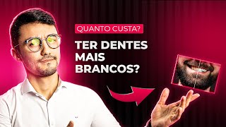 QUANTO CUSTA UM CLAREAMENTO DENTAL Caseiro ou no Consultório [upl. by Aihsein]