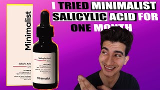 I Tried minimalist Salicylic Acid For A Month Is It Worth It  CHEMICAL EXFOLIANT [upl. by Gibbs]