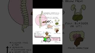 Automatic dysreflexia nursing nursingexam nclexreview [upl. by Merat736]