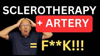 Sclerotherapy NIGHTMARE Accidental Artery Injection MUST WATCH The Most Important Complication [upl. by Rezal]