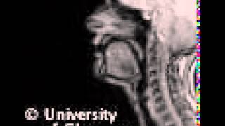 MRI voiceless bilibial fricative [upl. by Elauqsap]