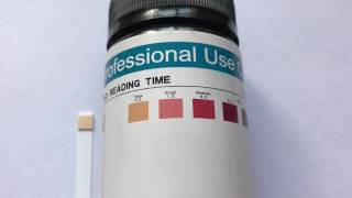 How to read ketone test strip results What are normal ketone levels [upl. by Ronica]