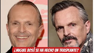 ¿Miguel Bosé se ha hecho un trasplante de pelo o es ingeniería capilar [upl. by Dleifniw]