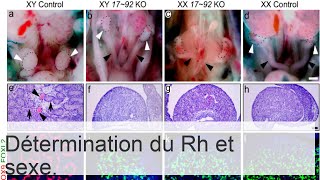 Détermination du facteur Rh du fœtus dans le sang de la mère  méthodes de diagnostic et de calcul [upl. by Cammie330]