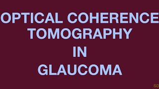 Glaucoma Session 10 Posterior Segment Imaging [upl. by Sausa]