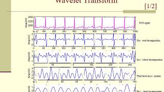 ECG Arrhythmia Classification using Support Vector Machine SVM  ECG [upl. by Eelsew]