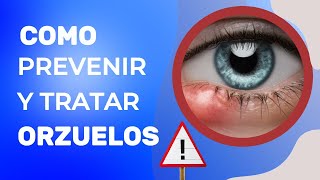 ¿Cómo prevenir y tratar los ORZUELOS [upl. by Elyrad]