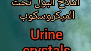 املاح البول تحت الميكروسكوب urine crystals [upl. by Nimrak]