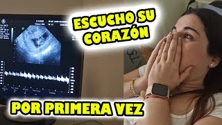 ESCUCHO POR PRIMERA VEZ EL CORAZÓN DE MI BEBÉ [upl. by Sofko]