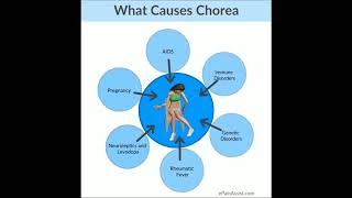 Sydenham chorea SD [upl. by Ecyrb]