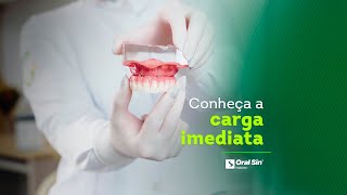 Carga imediata agiliza os implantes dentários [upl. by Nylhtac]