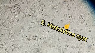 Entamoeba Histolytica trophozoite cyst Stool examination stoolanalysis gse stooltest [upl. by Ydnak]