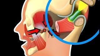 Besonderheiten des Kiefergelenks [upl. by Caravette857]