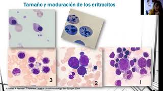 Laboratorio de Hematología Frotis de sangre periférica citometría hemática [upl. by Onibas109]