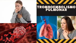 Tromboembolismo pulmonar Terapia [upl. by Haceber]